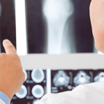 doctor with Rontgen result