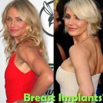 breast implant result on celebrity 2