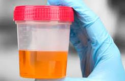 urine inside cup