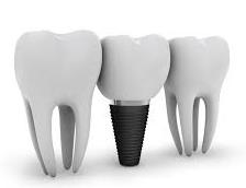 dental