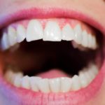 woman mouth opened