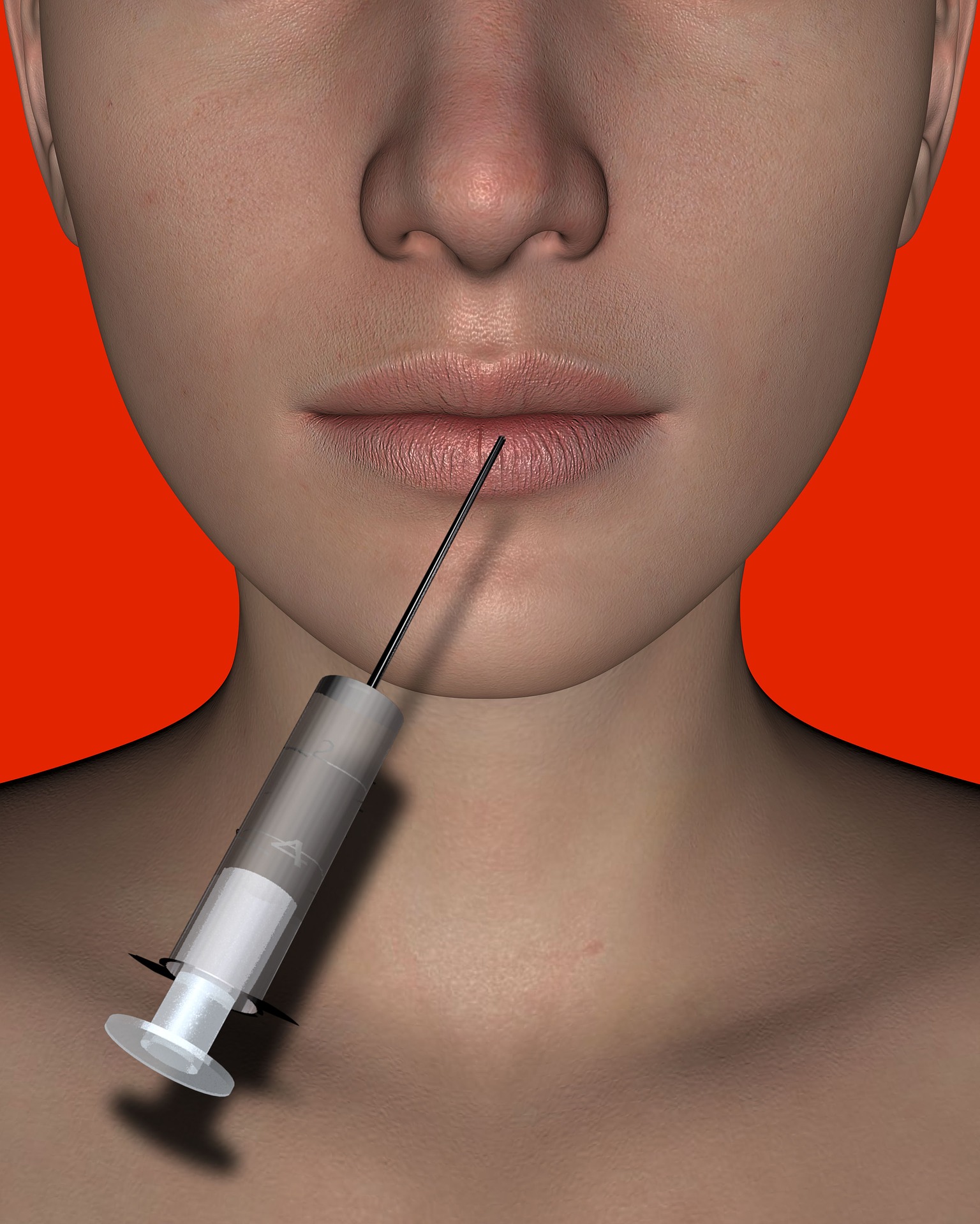 collagen filler
